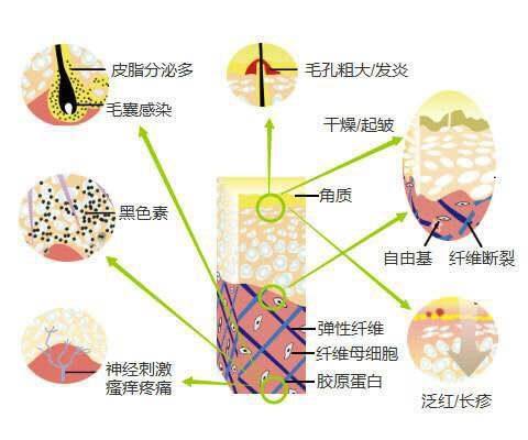 淡斑小知識、祛斑誤區